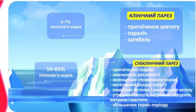 ПАРЕЗ (гіпокальціємія)